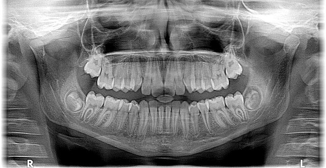 How Hormones Can Impact The Health Of Your Gums | Eclectic Evelyn